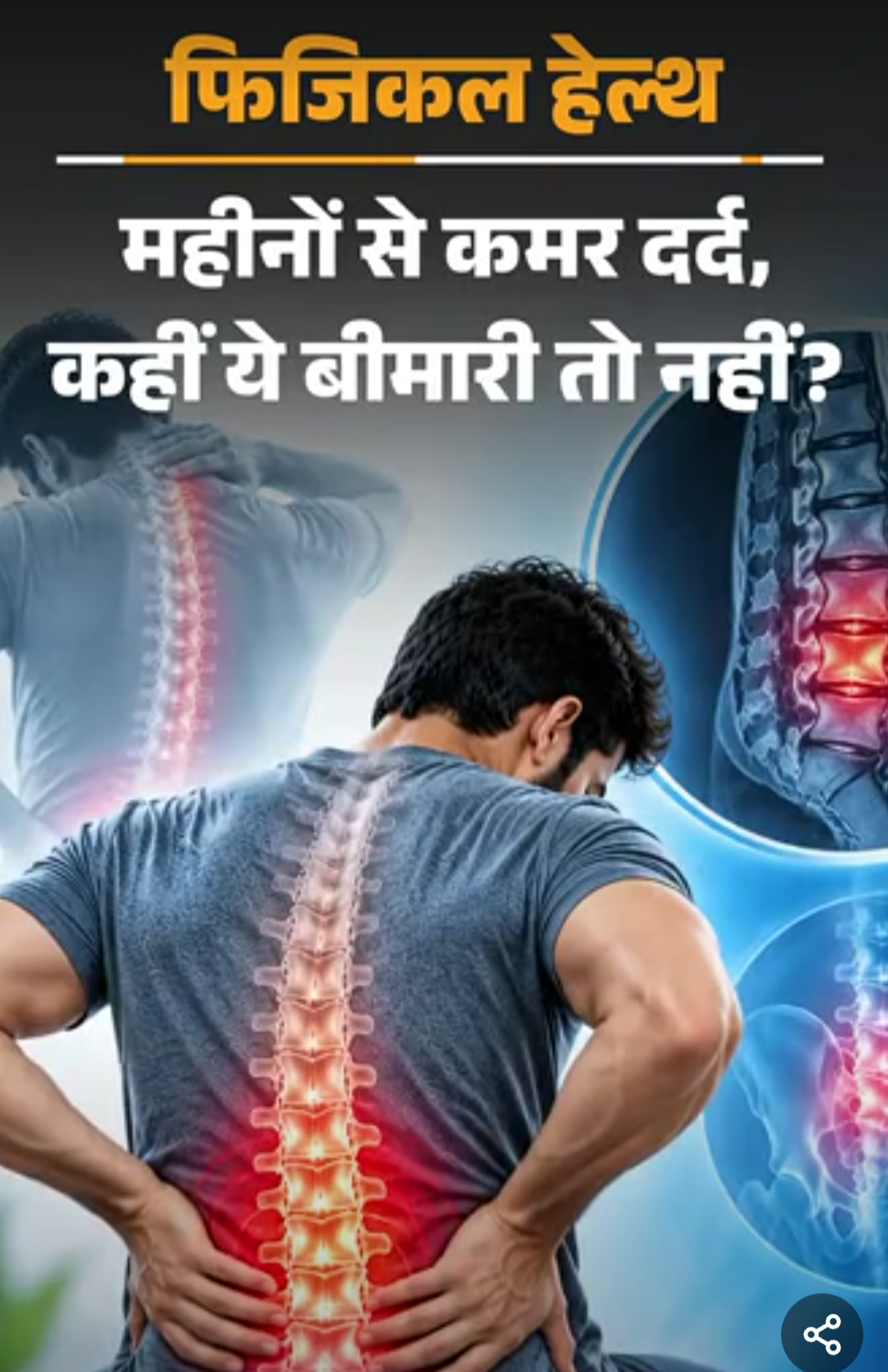फिजिकल हेल्थ- कमर में दर्द को इग्नोर न करें:हो सकता है एंकिलोजिंग स्पॉन्डिलाइटिस, डॉक्टर से जानें इसके लक्षण और बचाव के तरीके
