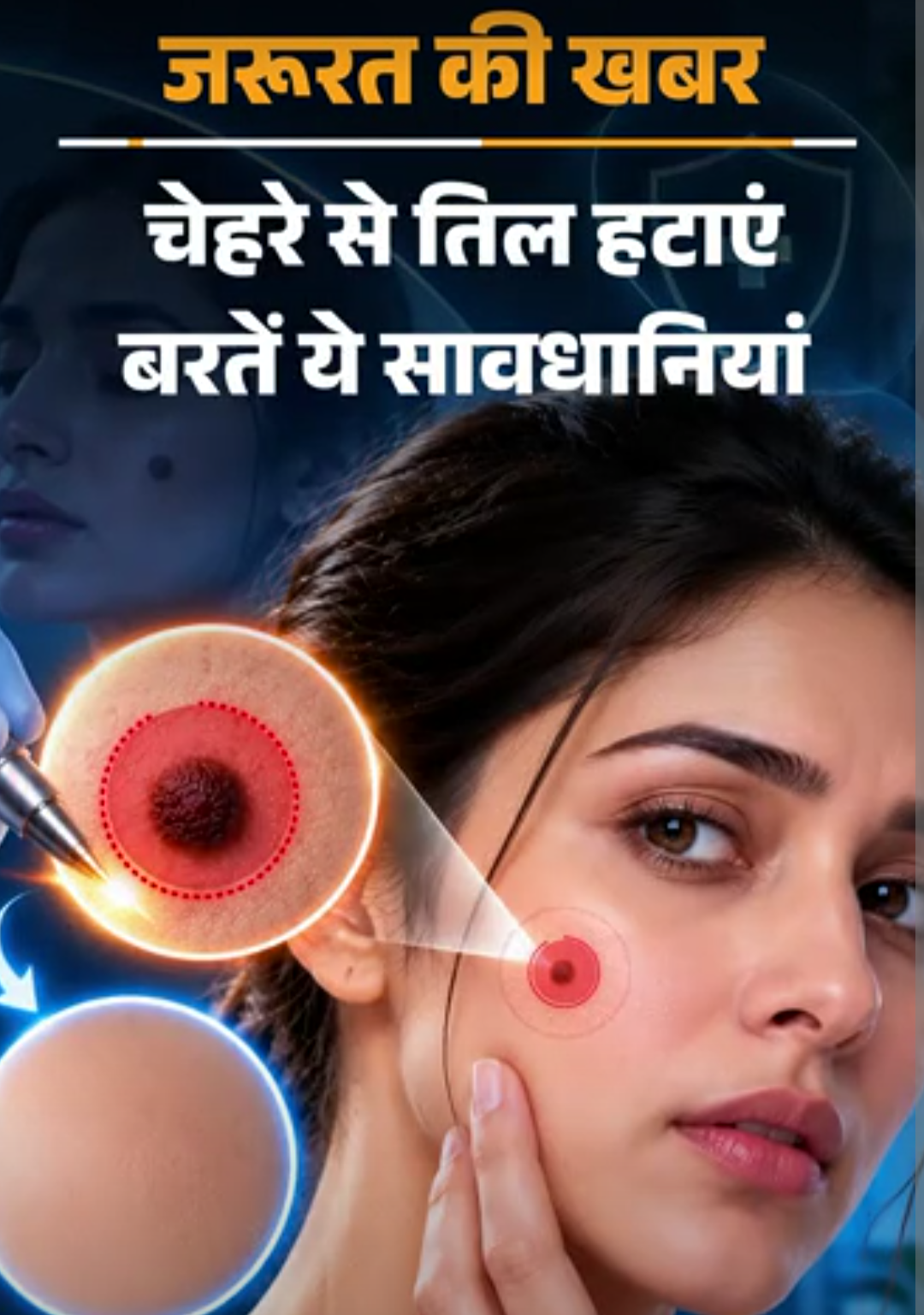 जरूरत की खबर- चेहरे से अनचाहे तिल कैसे हटाएं:डर्मेटोलॉजिस्ट से समझें पूरा प्रोसेस, संभावित खतरे, तिल हटवाने के बाद 10 सावधानियां